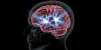 1000153240.webp 1000153240.webp